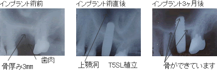 バイオメソッドの症例2
