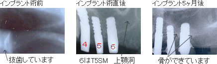 バイオメソッドの症例3