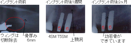バイオメソッドの症例5