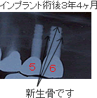 バイオメソッドの症例5
