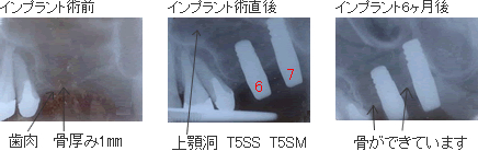 バイオメソッドの症例4