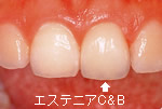 エステニア
